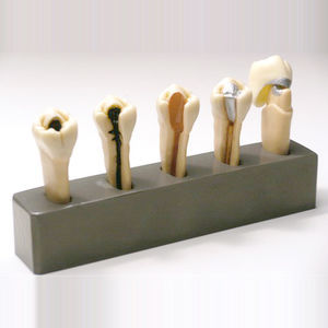 modello anatomico di denti 1