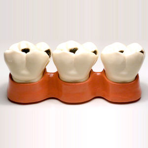 modello anatomico di denti 1