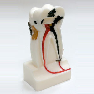 modello anatomico di denti 1