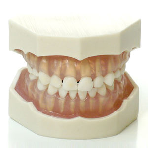 modello anatomico di denti 1