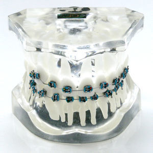 modello anatomico di denti 1