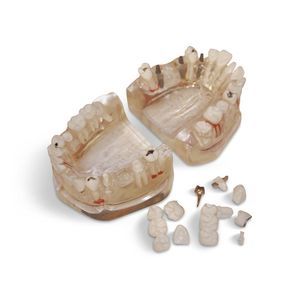 modello anatomico di denti 1