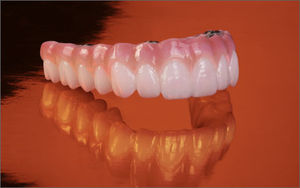 protesi dentale in zircone / per denti posteriori / per denti anteriori