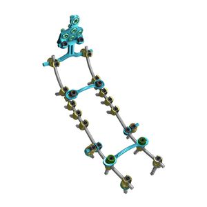 sistema di osteosintesi occipito-cervico-toracico 1