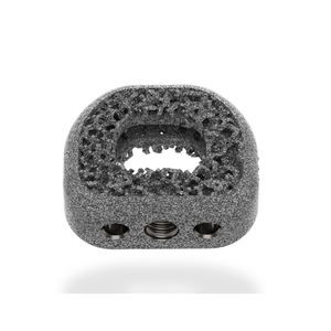 gabbia intersomatica cervicale