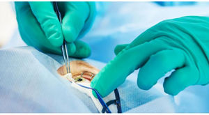 kit medico per chirurgia oftalmica