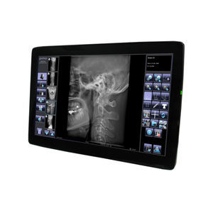 sistema di acquisizione per radiografia 1