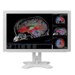 monitor per diagnostica per immagini