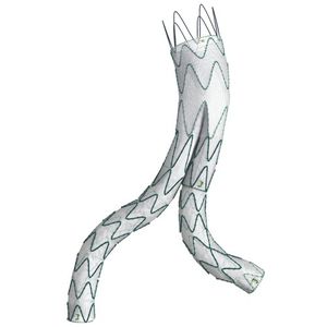 innesto stent aorta addominale