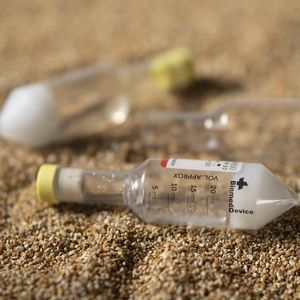 provetta per plasma ricco in piastrine