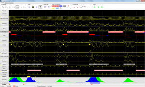 software per ospedale