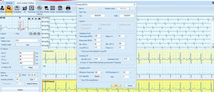 software per ECG