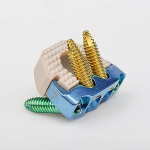 gabbia intersomatica cervicale