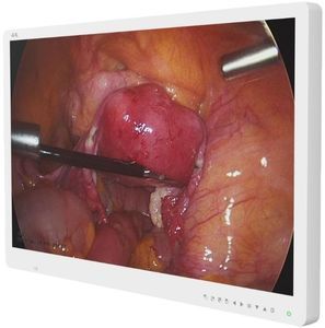 monitor medico