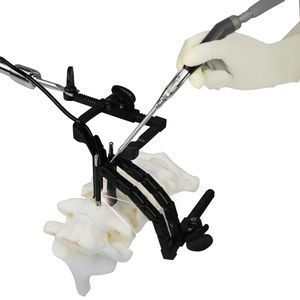 divaricatore cervicale