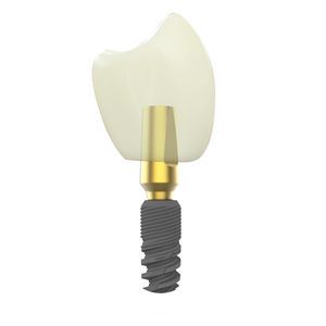 impianto dentale conico 1