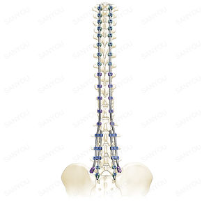 sistema di osteosintesi toraco-lombo-sacrale