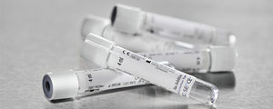 provetta per prelievi da laboratorio 1