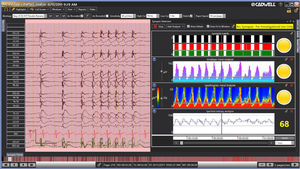 software per EEG