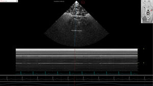 modulo software per ecocardiografia