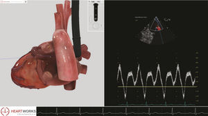 modulo software per ecocardiografia