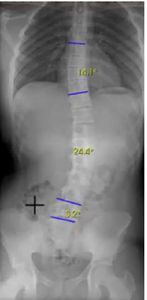 software per radiografia