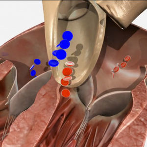 modulo di simulazione per ecocardiografia 1