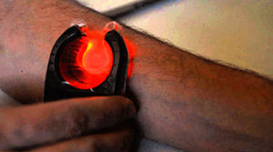 rilevatore di vene a LED 1