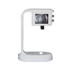 rilevatore di vene a LED 1
