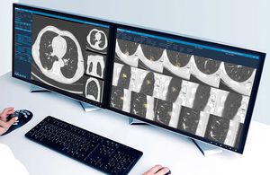 software di analisi delle immagini