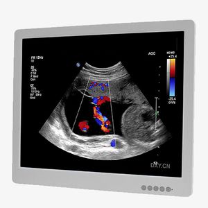 monitor per ecografia