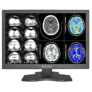 monitor per diagnostica per immagini