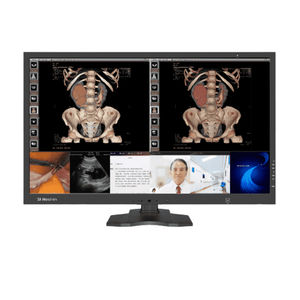 monitor diagnostico