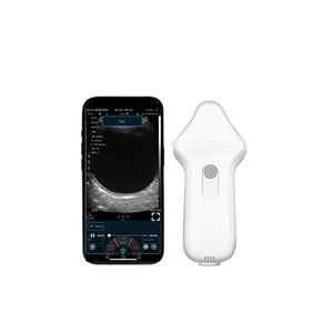sonda doppler
