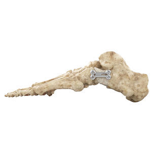 placca per osteotomia per alluce valgo 1