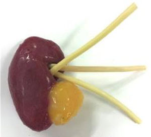 modello anatomico rene