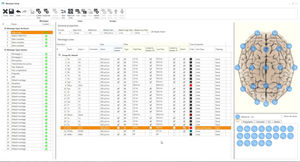 software di analisi