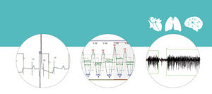 software di analisi / di controllo / di post elaborazione / cardiovascolare