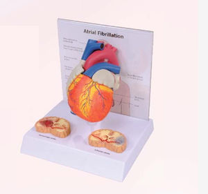 modello anatomico di cornea