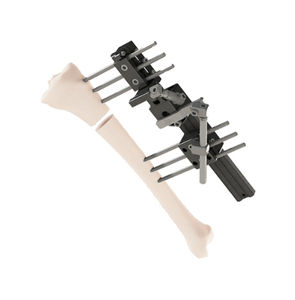 fissatore esterno per tibia