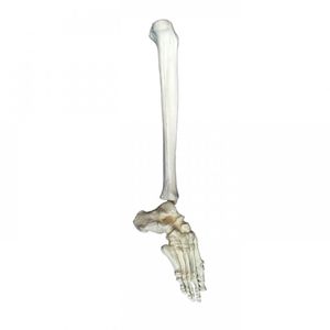 modello anatomico piede / tibia / ad uso didattico / di patologia
