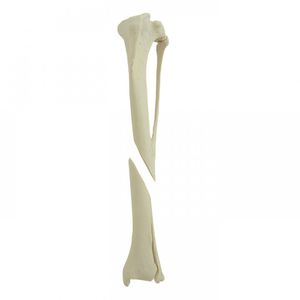 modello anatomico di tibia