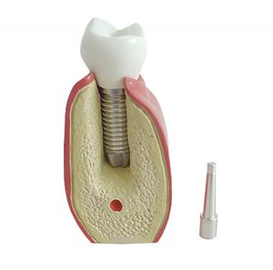 modello anatomico odontoiatrico