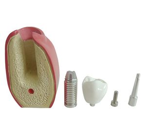 modello anatomico odontoiatrico 1