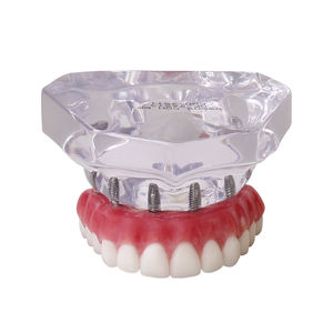 modello anatomico di dentatura