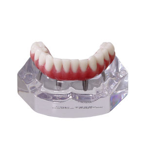 modello anatomico di dentatura