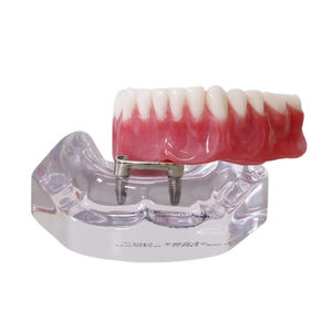 modello anatomico di dentatura 1