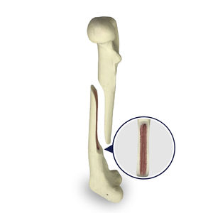 modello anatomico di femore 1