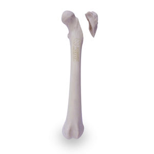 modello anatomico di femore 1