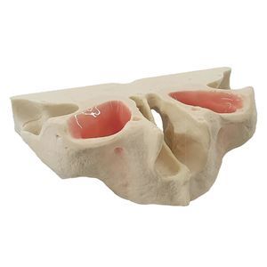 tipodonto di mascella 1